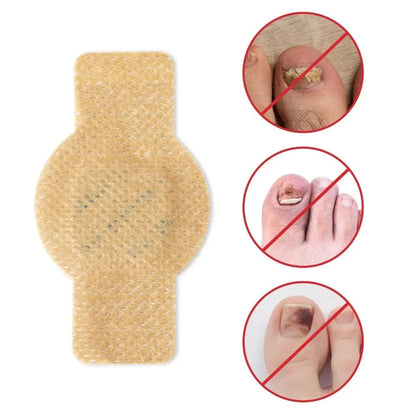 #1 Fungal Nail Patches